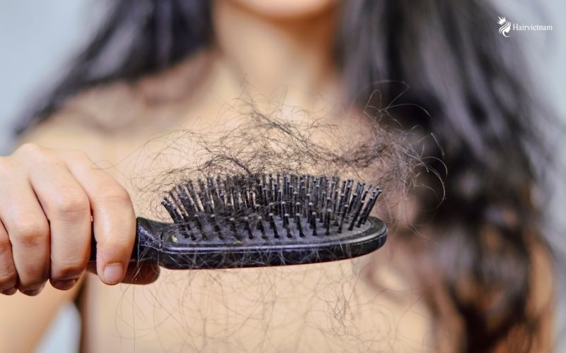How long does Postpartum Hair Loss last?