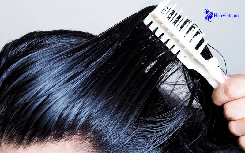 What are the causes of hair getting greasy quickly?