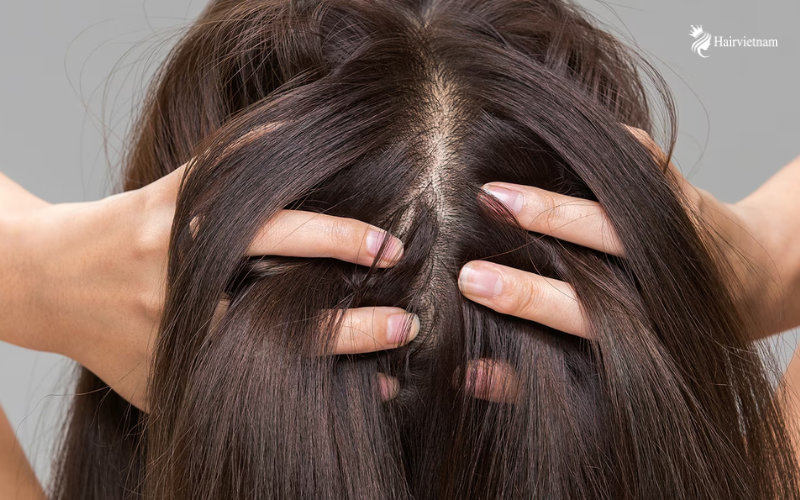 Understanding the Scalp