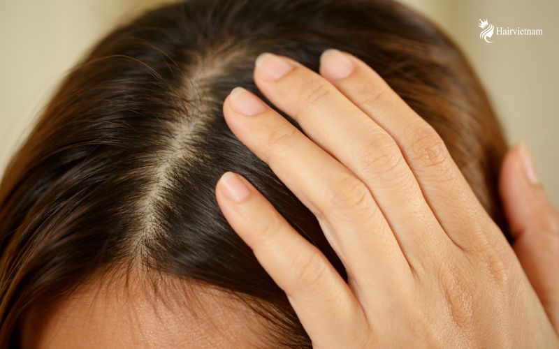 Benefits of Scalp Detox